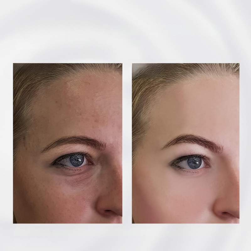 Lyft & Glow ansiktsskulpteringstav - Anti-aging massageapparat i rostfritt stål