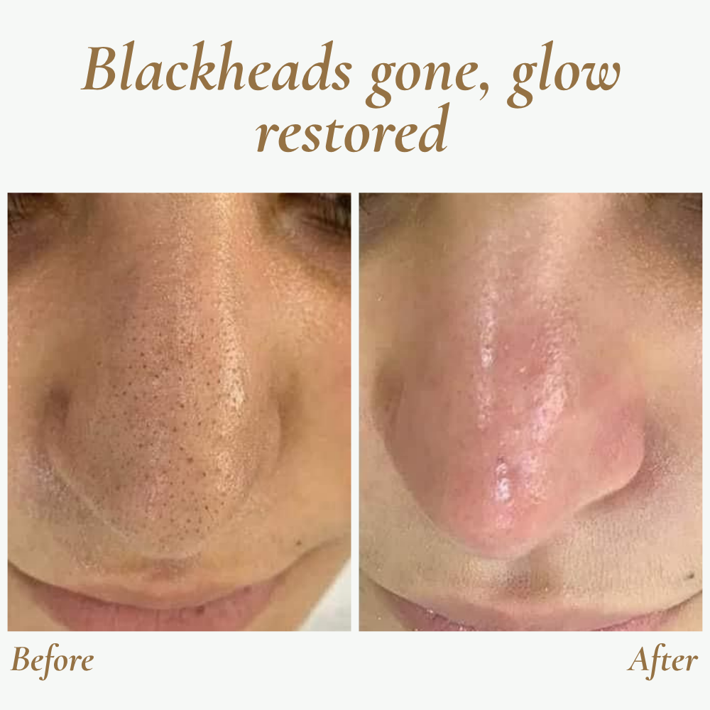 Ultraljudsskrubber för hudförnyelse - Resevänlig ansiktsapparat