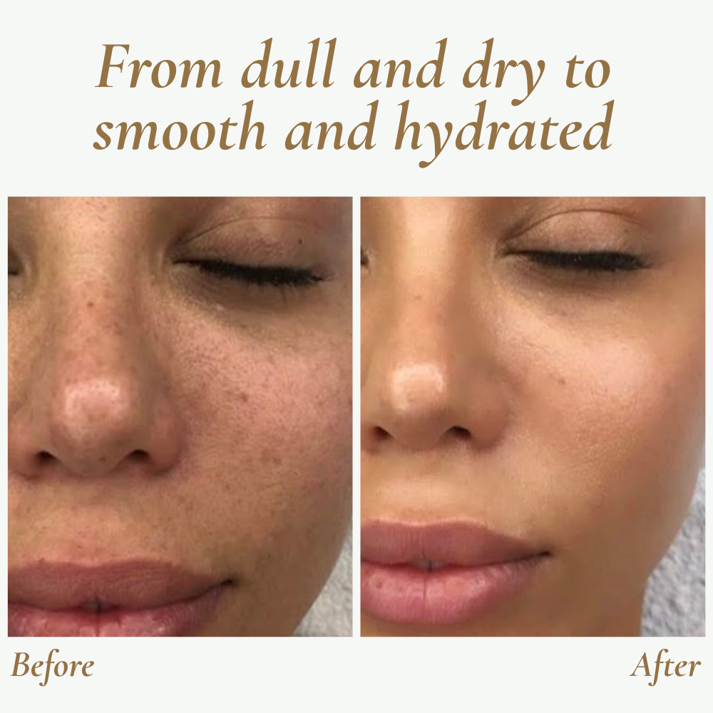 Ultraljudsskrubber för hudförnyelse - Resevänlig ansiktsapparat