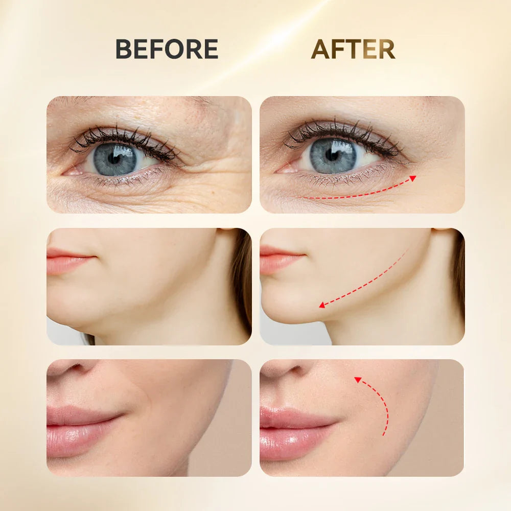 Revitaliserande akupressur ansiktsmassage – Avslappnings- och hudterapiverktyg